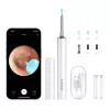 Limpador de ouvidos Bebird T15 Smart Visual branco — otoscópio visual para limpeza dos ouvidos