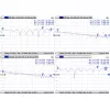 Cabo Mmcx para RPSMA/ACMMCXRPSMA Mikrotik