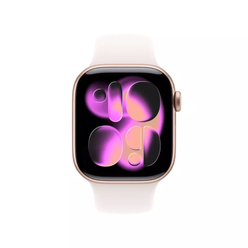APPLE Watch Series 11 GPS + Cellular 42mm Caixa de alumínio rosa-ouro com pulseira desportiva light blush S/M