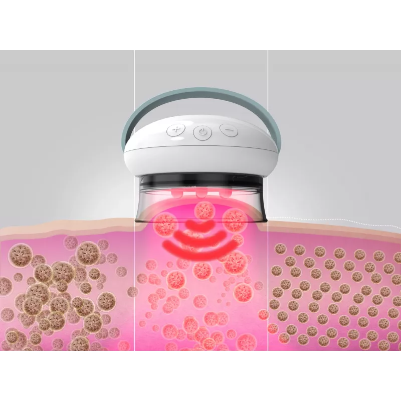 Massajador HoMedics Smoothee IR Pernas Branco 4 cabeças a pilhas