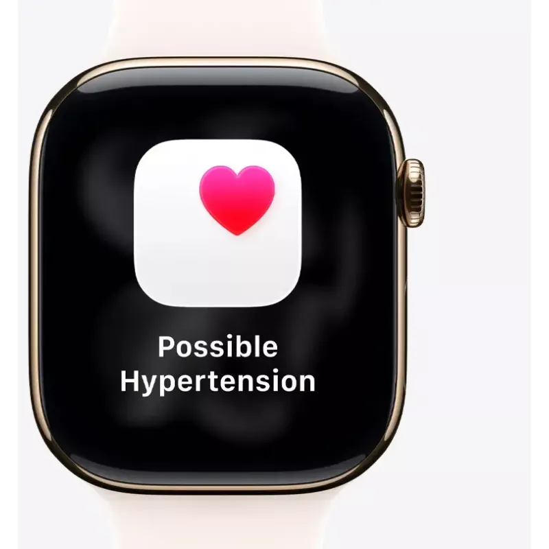 Smartwatch Apple MFD04ET/A — Apple Watch (Modelo MFD04ET/A)