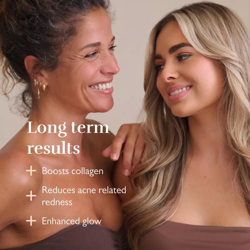 Silk'n LED Face Mask Pro FLMP1PE1001 - Máscara de Fototerapia LED Anti-Idade e Acne