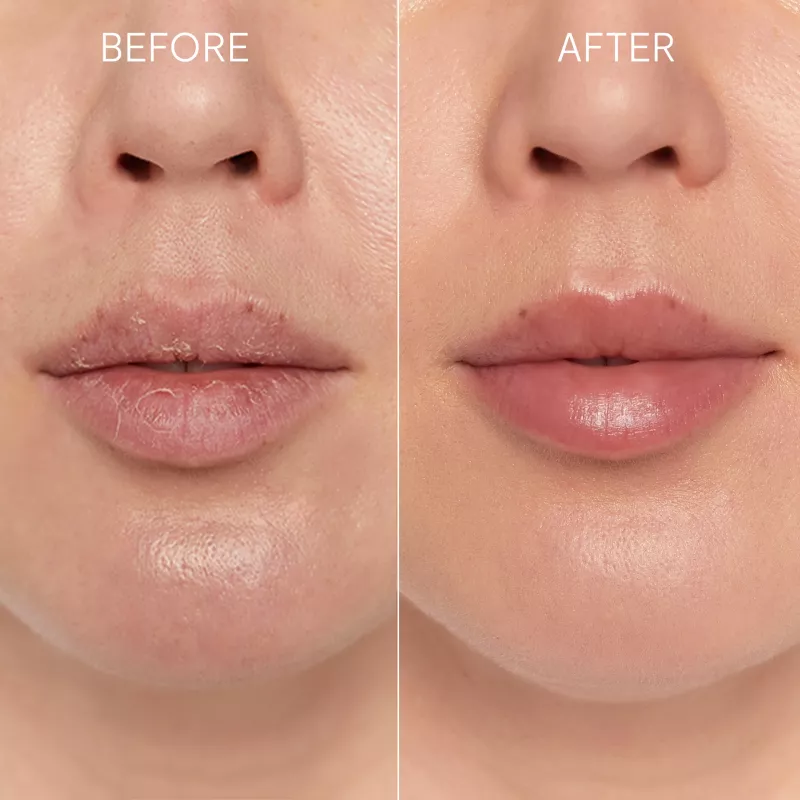 GLOV Scrubex Lip Exfoliating Mitt - pack de 2 | Peeling labial suave em microfibra para lábios macios